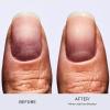 imageOPI Nail Envy 05 fl oz and OPI Start to Finish 3in1 Treatment Base Coat Top Coat Nail Strengthener 05 fl oz